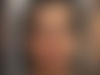 Exame encontra esferas escuras no organismo de jovem que pode ter sido envenenado pela madrasta.