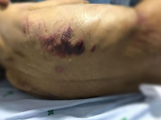 GO: pastores são donos de clínica clandestina que torturava pacientes