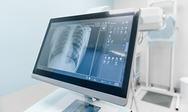 Chest X-ray displayed on monitor showing lungs and rib cage
