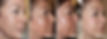 Innovative Chemical Peel Facial Peeling progression