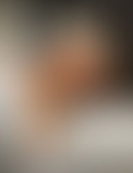 Unlocking Radiant Skin: The Essence of Holistic Esthetics