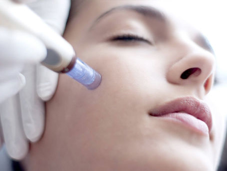 Microneedling; an effective collagen induction therapy