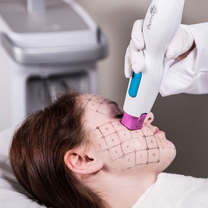 Thermage FLX in London
