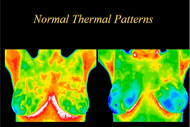 thermal breast.png