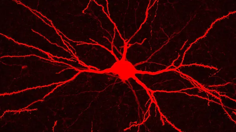 black and red neuron.webp