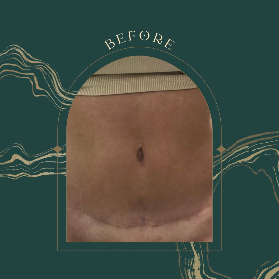 Dark Green Elegant Oriental Gothic Marble Before After Tattoo Instagram Post - 2