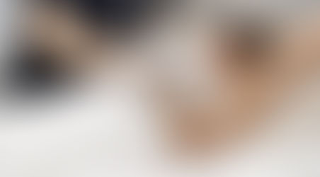 Hair Removal Laser Perth: What to Know First