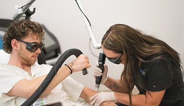 Tattoo Removal
