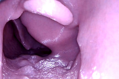 AIRWAY_MASS-3.jpg