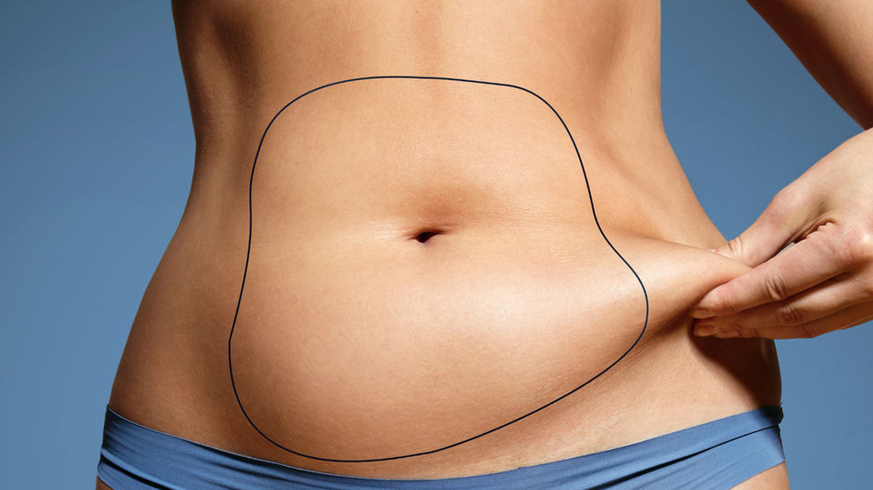 Tiny Tweaks, Big Impact. The Magic of Micro liposuction
