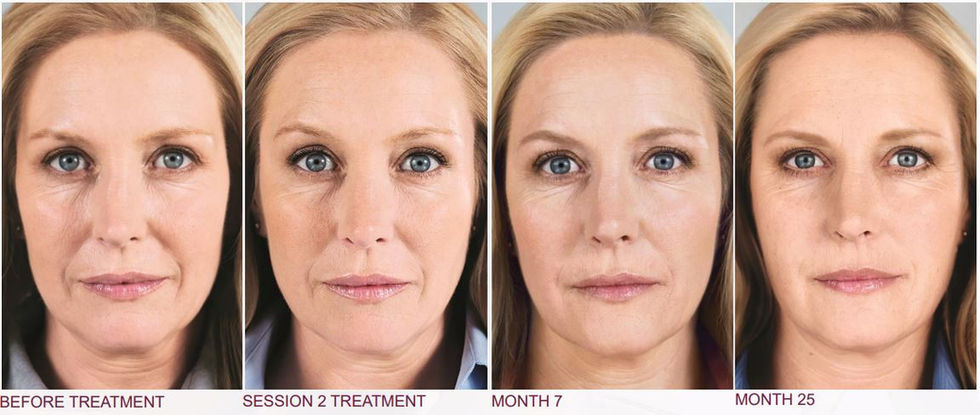 The Secret to a Youthful Face