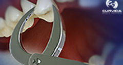 extraction_braces (0-00-15-25)webweb.jpg