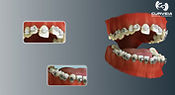 braces_images_setting_01t-web.jpg