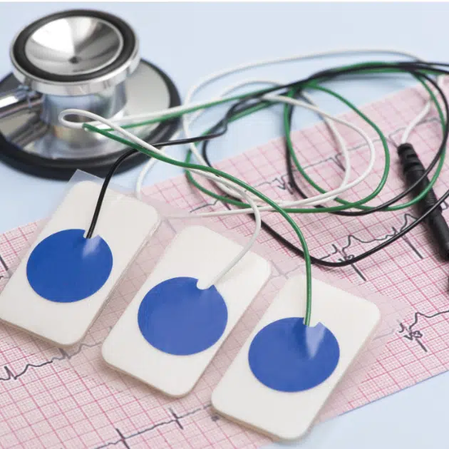 EKG.1.png.webp