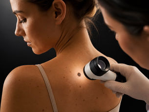 How Often Should You Have a Skin Check?