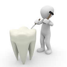 tooth-1015409_1920.jpeg
