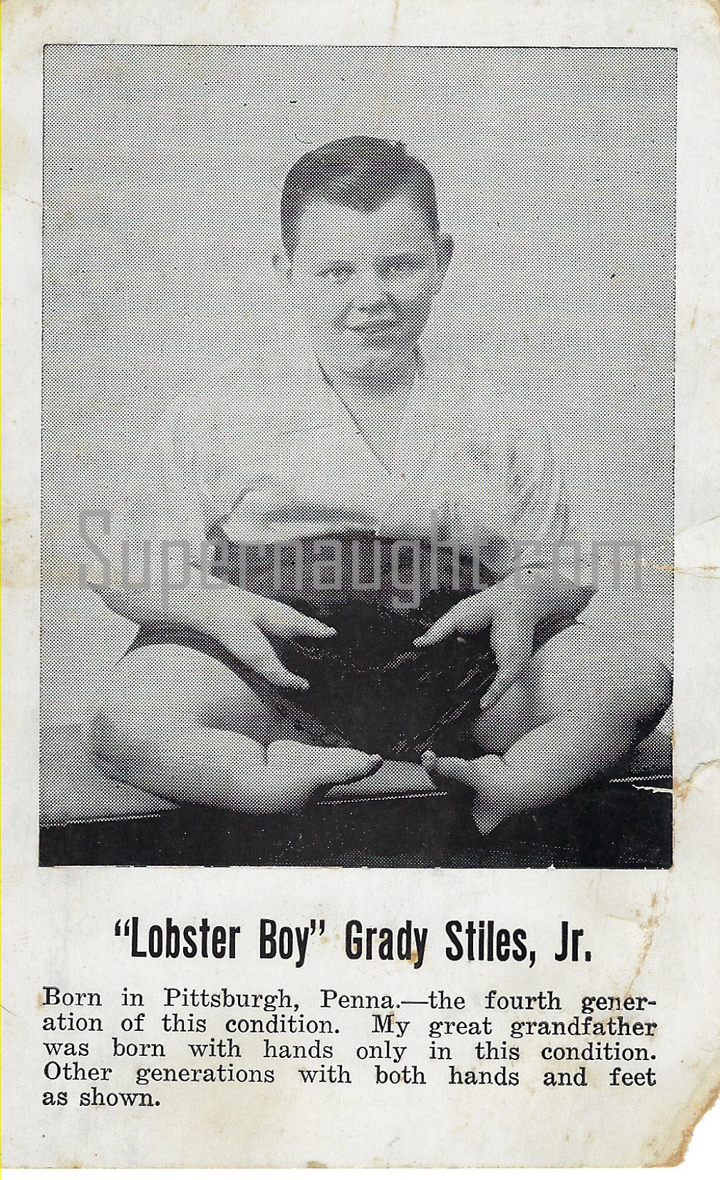 Grady Stiles Lobster Boy autograph