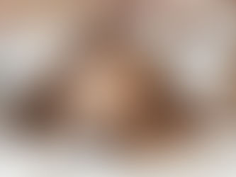 Linfoma Intestinal Canino