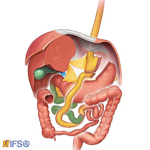 Bypass Gástrico em Y-de-Roux