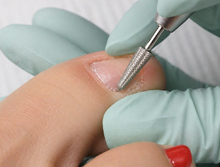 keryflex-toenail-restoration-Near-me.png