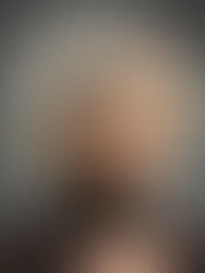 Reclaiming Confidence: My journey helping women with hair loss