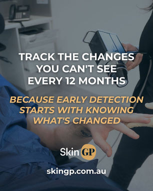 Close-up of a doctor performing dermoscopy on a patient's arm using a FotoFinder device at SkinGP Woodend, illustrating total body photography used to track skin changes over time.