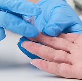 Finger Prick