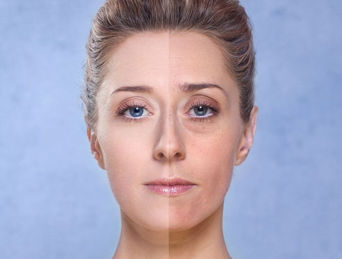 Manfaat Salicylic Acid Kepada Kulit
