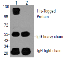 縮圖：YH80023S His-Tag (10E2) mAb