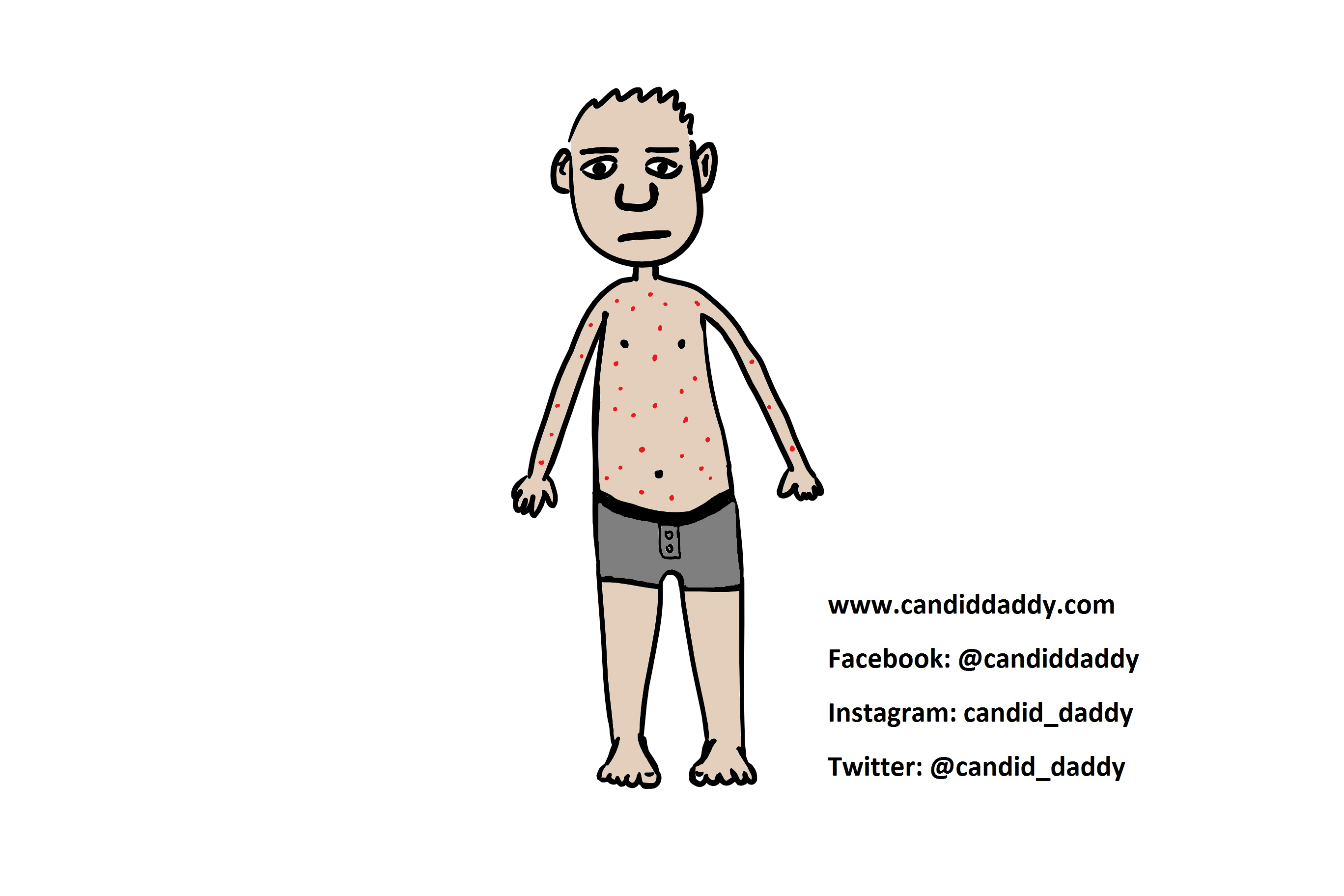 Candid Daddy - Chicken Pox 1