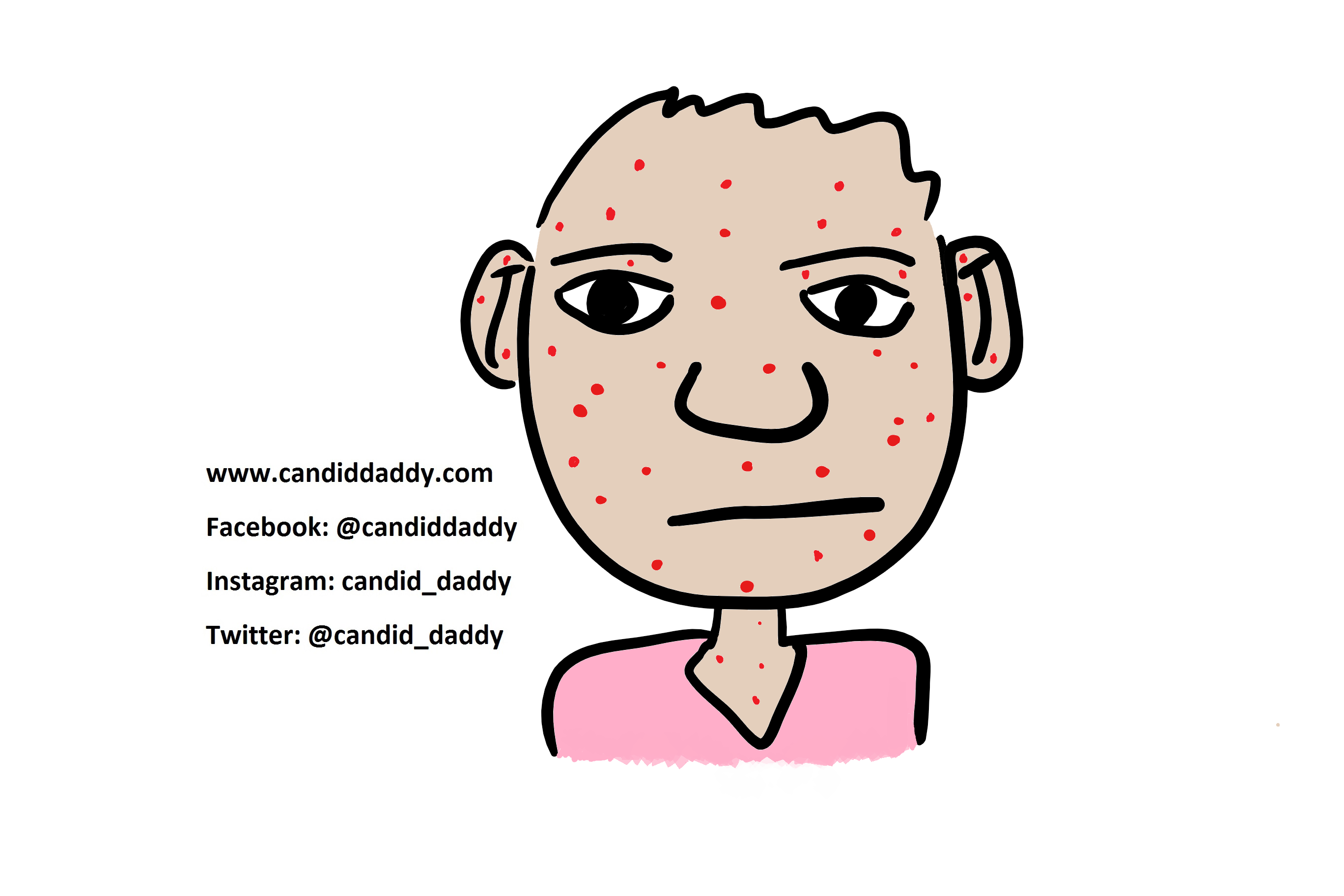 Candid Daddy - Chicken Pox 2