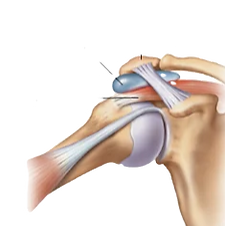 image (18)_edited.png