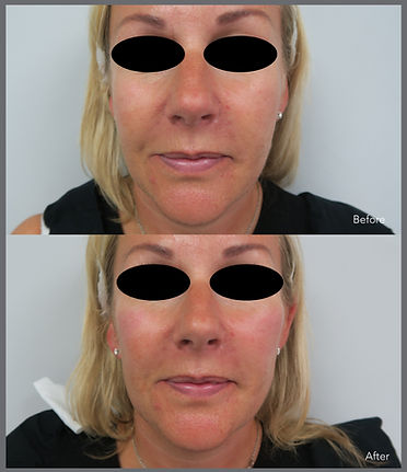 Before & After - Front copy.jpg