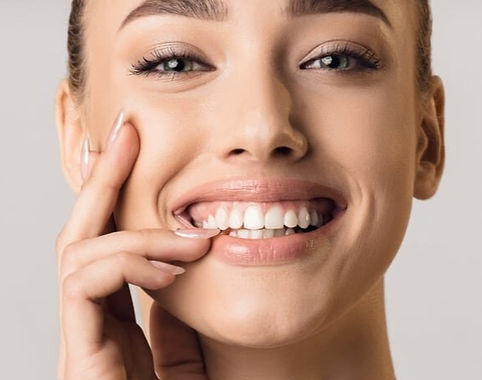 Reduce-appearance-of-gums-with-gummy-smile-botox-siti-med-spa-san-diego (1)_edited.jpg