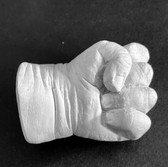 Babyhand in Gips
Babybauch