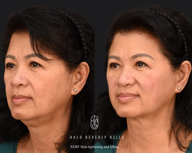Before and After 10.png