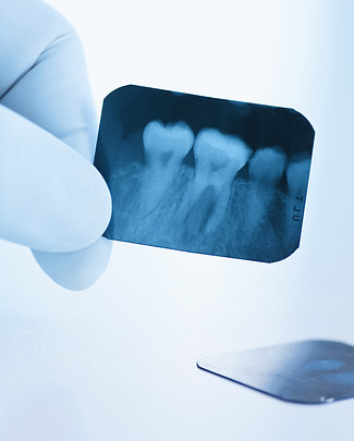 Dental X-ray Film_edited.jpg