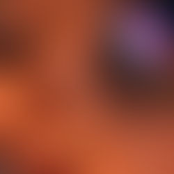 Discover Illume Esthetics: Your Journey to Radiant Skin