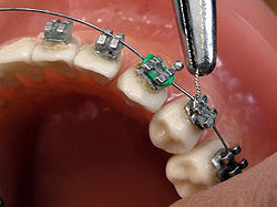 Orthodontics and Dentofacial Orthopedics AIOI Fellowship program