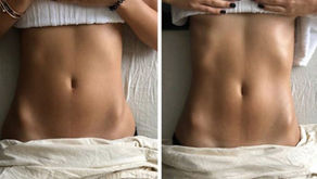 4 key benefits of lymphatic drainage.