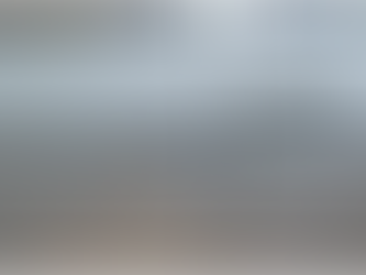 Why You Should Never Ignore Minor Dents and Scratches on Your Car