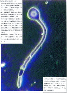 がん治療鍼灸