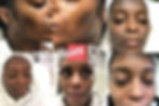 Chemical Peel at 247 Natural Wellness Center