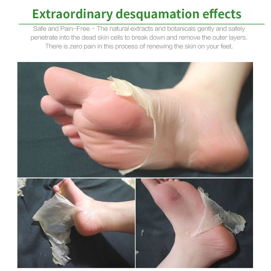 Thumbnail: Moisturizing Foot Mask for Exfoliation and Care