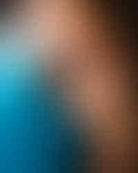 a man in a blue tank top has veins on his arm