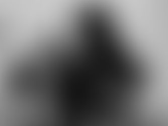 La conexión entre el bruxismo y los acúfenos