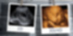 3d-4d-ultra-sound