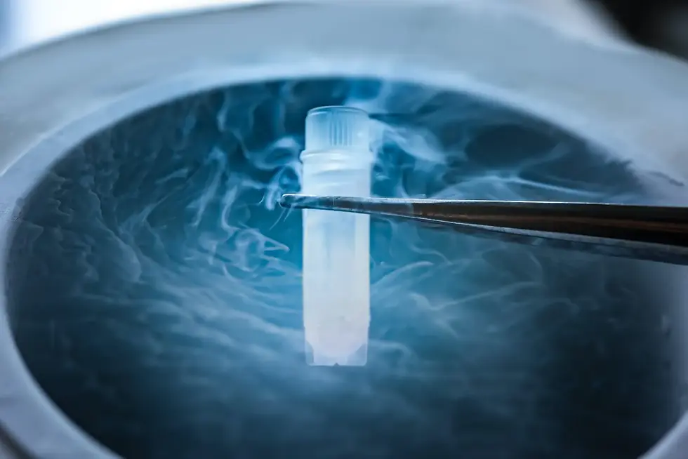 Cryopreservation tube
