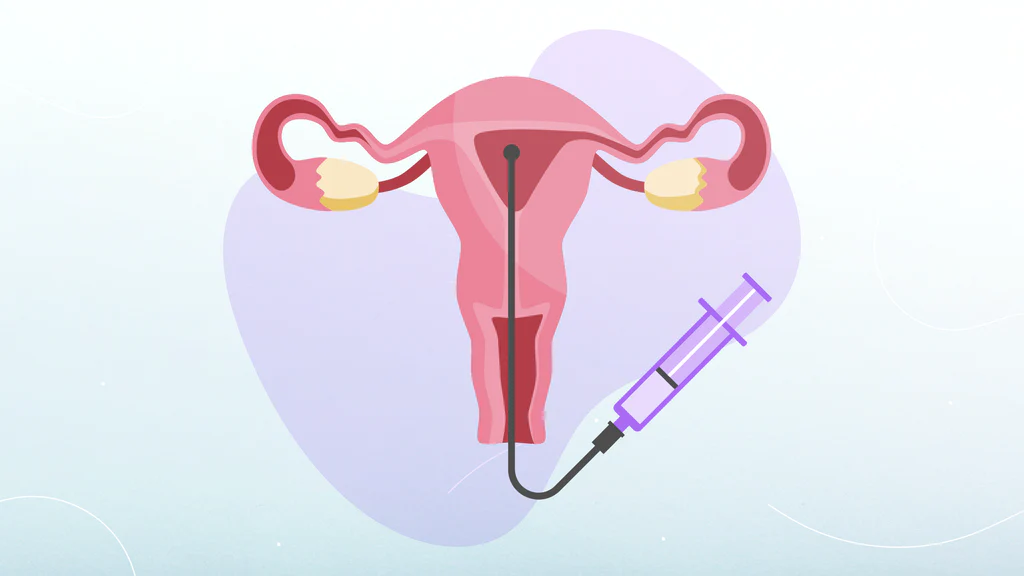 iui-treatment-vijayawada
