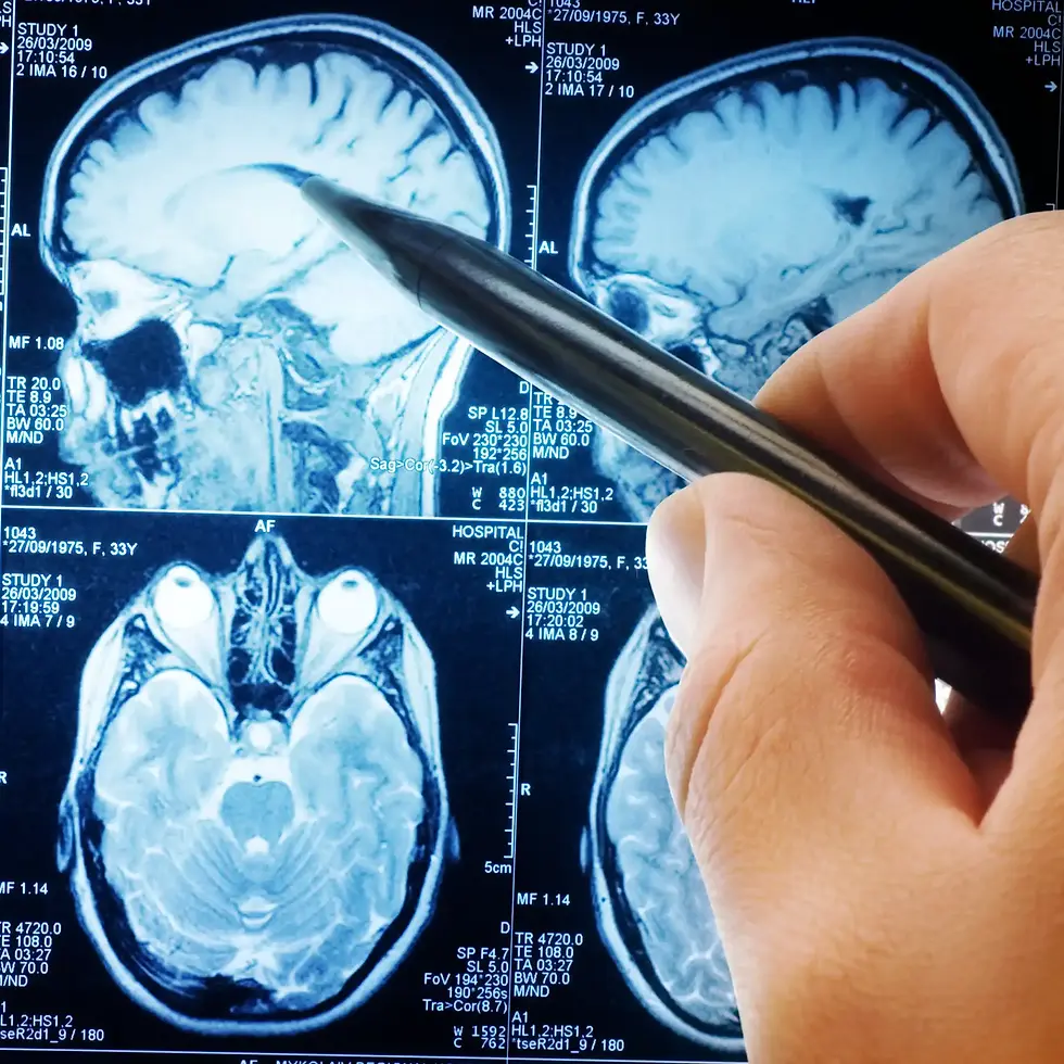 Brain MRI scan analysis by specialist